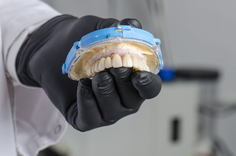 An image of zirconia dental implants.