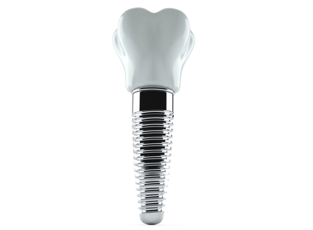 a single dental implant with a white background.
