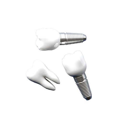 tooth and two implants